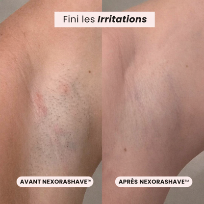 Nexora Shave